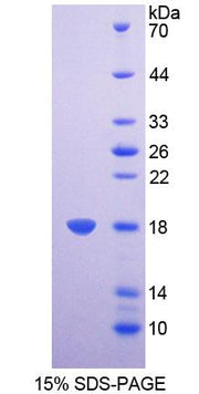 Figure 1. SDS-PAGE