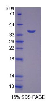 Figure 1. SDS-PAGE