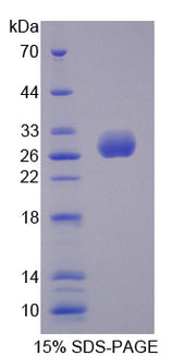 Figure 1. SDS-PAGE