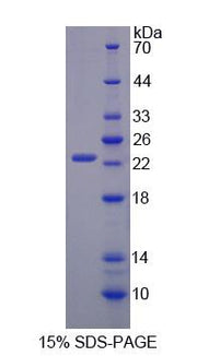 Figure 1. SDS-PAGE