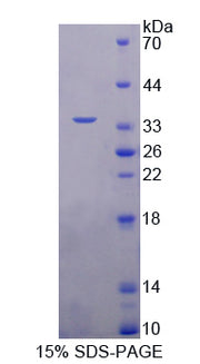 Figure 1. SDS-PAGE