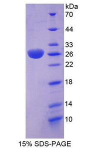 Figure 1. SDS-PAGE