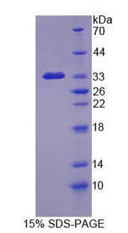 Figure 1. SDS-PAGE