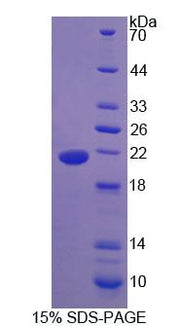 Figure 1. SDS-PAGE