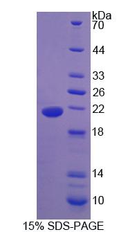 Figure 1. SDS-PAGE