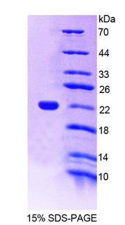 Figure 1. SDS-PAGE