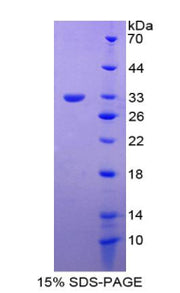Figure 1. SDS-PAGE