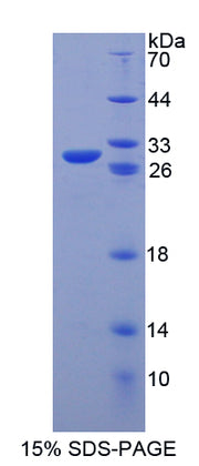 Figure 1. SDS-PAGE