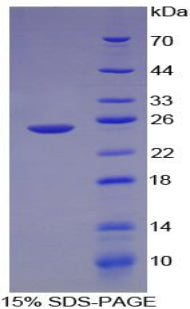 Figure 1. SDS-PAGE