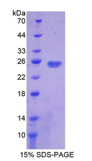 Figure 1. SDS-PAGE