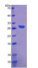 Figure 2. SDS-PAGE