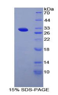 Figure 1. SDS-PAGE