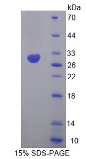 Figure 1. SDS-PAGE