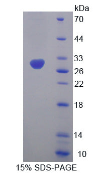 Figure 1. SDS-PAGE