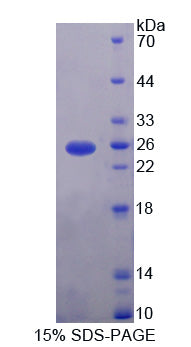 Figure 1. SDS-PAGE