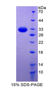 Figure 1. SDS-PAGE
