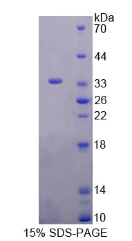 Figure 1. SDS-PAGE