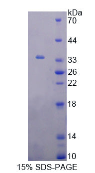 Figure 1. SDS-PAGE