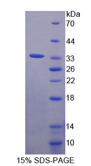 Figure 1. SDS-PAGE