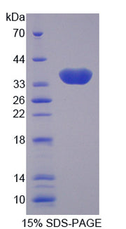Figure 1. SDS-PAGE