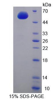 Figure 1. SDS-PAGE