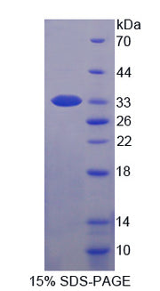 Figure 1. SDS-PAGE