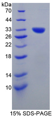 Figure 1. SDS-PAGE