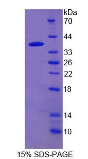 Figure 1. SDS-PAGE