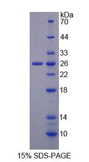 Figure 1. SDS-PAGE