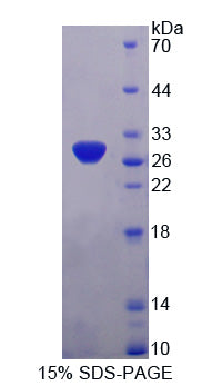 Figure 1. SDS-PAGE