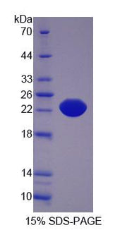 Figure 1. SDS-PAGE