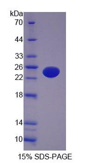 Figure 1. SDS-PAGE