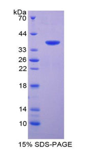 Figure 1. SDS-PAGE