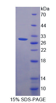 Figure 1. SDS-PAGE