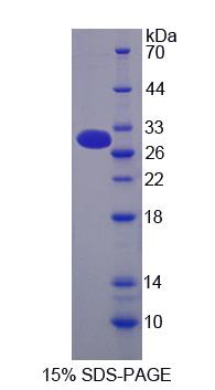 Figure 1. SDS-PAGE