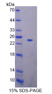 Figure 1. SDS-PAGE