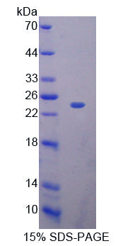 Figure 1. SDS-PAGE