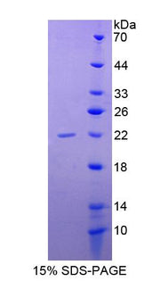 Figure 1. SDS-PAGE