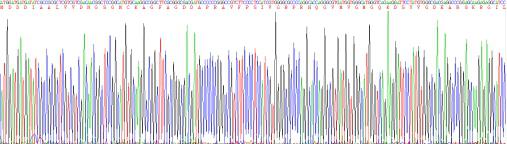 Recombinant Human Beta Actin (ACTB)