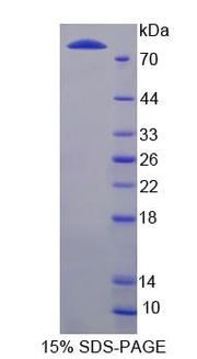 Figure 1. SDS-PAGE