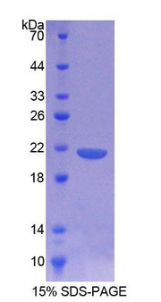 Figure 1. SDS-PAGE