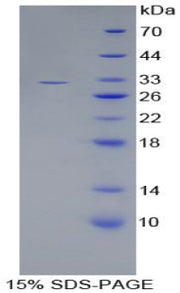 Figure 1. SDS-PAGE