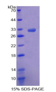 Figure 1. SDS-PAGE