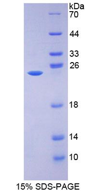 Figure 1. SDS-PAGE