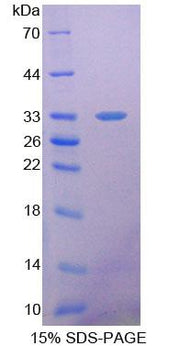 Figure 1. SDS-PAGE
