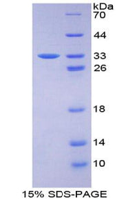 Figure 1. SDS-PAGE