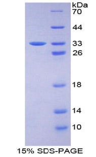 Figure 1. SDS-PAGE
