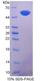 Figure 1. SDS-PAGE