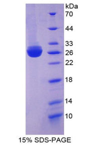 Figure 1. SDS-PAGE