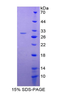 Figure 1. SDS-PAGE